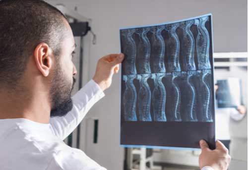Doctor views spine x-ray, Boise personal injury lawyer concept